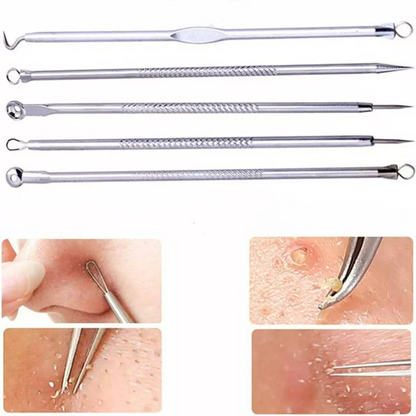 KIT DE PINZAS PARA ESPINILLAS