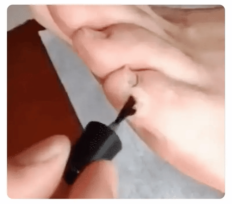 GEL ANTI-HONGOS Y CALLOS + ENVÍO GRATIS