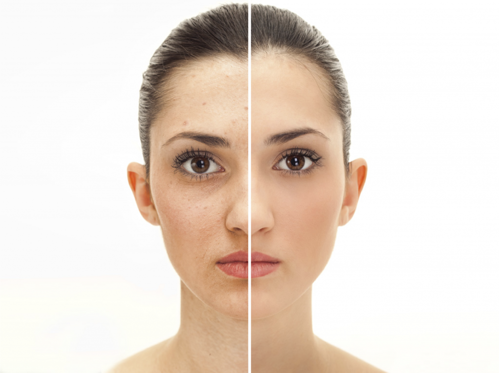 TÓNICO-CREMA ELIMINADOR DE MANCHAS