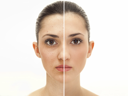 TÓNICO-CREMA ELIMINADOR DE MANCHAS