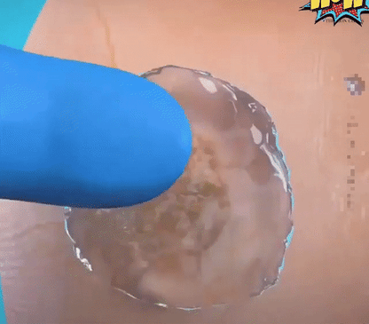 GEL ANTI-HONGOS Y CALLOS + ENVÍO GRATIS