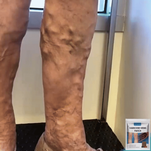 PARCHES PARA VENAS VARICES, PIERNAS PERFECTAS SIEMPRE PACK X 8 – Central home Colombia