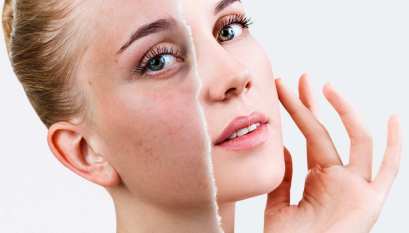 TÓNICO-CREMA ELIMINADOR DE MANCHAS