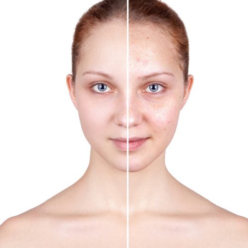 TÓNICO-CREMA ELIMINADOR DE MANCHAS